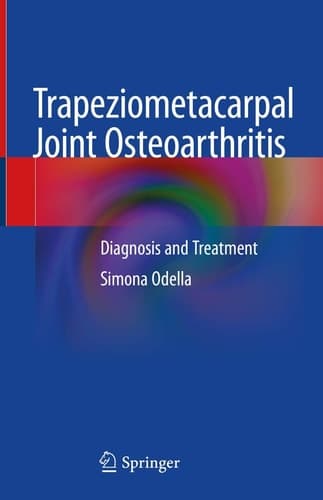Trapeziometacarpal Joint Osteoarthritis Diagnosis and Treatment