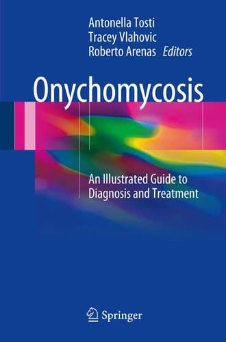 Onychomycosis An Illustrated Guide to Diagnosis and Treatment