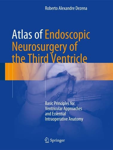 Atlas of Endoscopic Neurosurgery of the Third Ventricle Basic Principles for Ventricular Approaches and Essential Intraoperative Anatomy
