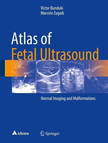 Atlas of Fetal Ultrasound Normal Imaging and Malformations