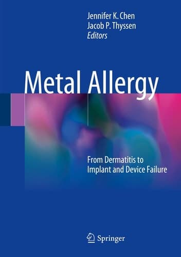 Metal Allergy From Dermatitis to Implant and Device Failure