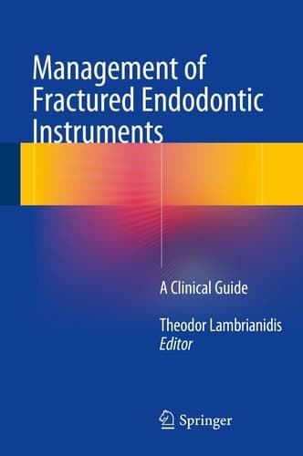 Management of Fractured Endodontic Instruments A Clinical Guide