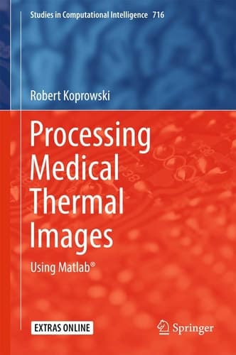 Processing Medical Thermal Images Using Matlab®