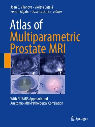 Atlas of Multiparametric Prostate MRI With PI-RADS Approach and Anatomic-MRI-Pathological Correlation