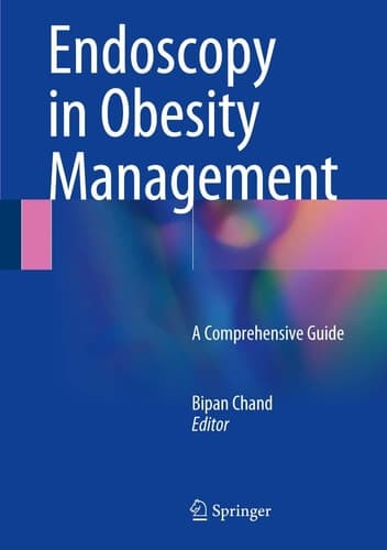 Endoscopy in Obesity Management A Comprehensive Guide