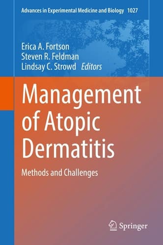 Management of Atopic Dermatitis Methods and Challenges