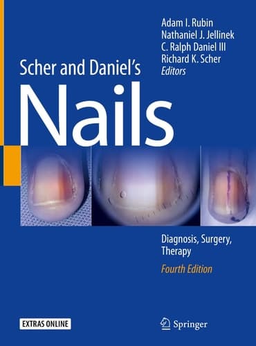 Scher and Daniel's Nails Diagnosis, Surgery, Therapy