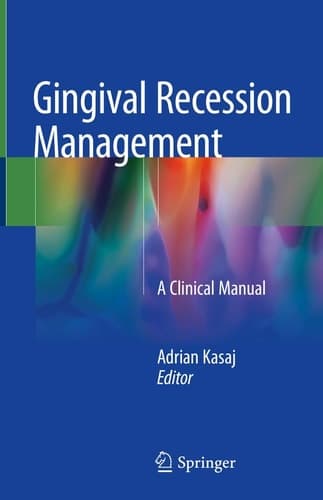 Gingival Recession Management A Clinical Manual