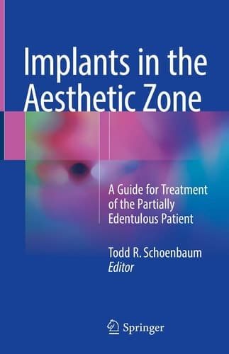 Implants in the Aesthetic Zone A Guide for Treatment of the Partially Edentulous Patient