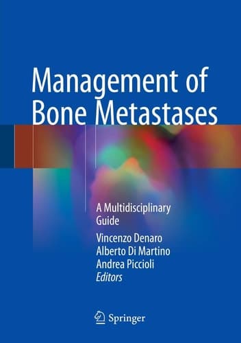 Management of Bone Metastases A Multidisciplinary Guide