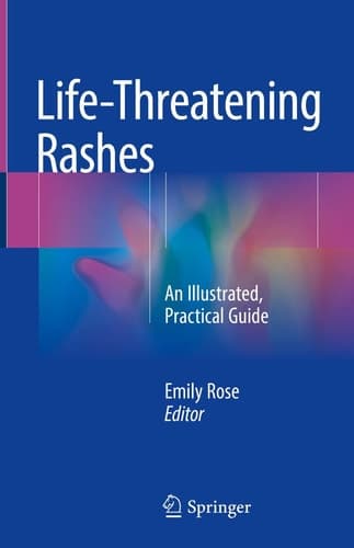 Life-Threatening Rashes An Illustrated, Practical Guide