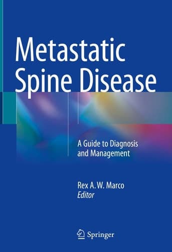 Metastatic Spine Disease A Guide to Diagnosis and Management
