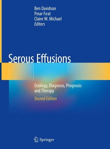 Serous Effusions Etiology, Diagnosis, Prognosis and Therapy