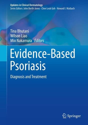 Evidence-Based Psoriasis Diagnosis and Treatment