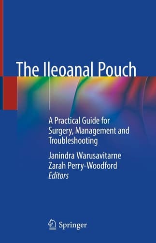 The Ileoanal Pouch A Practical Guide for Surgery, Management and Troubleshooting