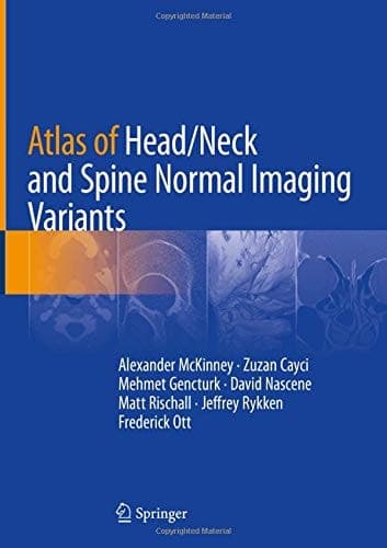 Atlas of Head/Neck and Spine Normal Imaging Variants