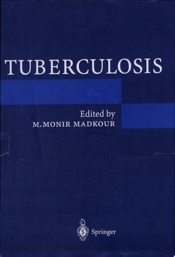 Tuberculosis