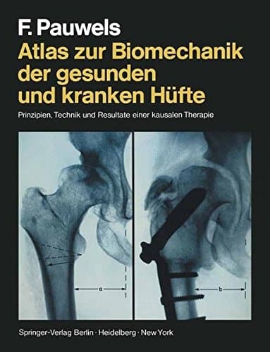Atlas zur Biomechanik der gesunden und kranken Hüfte Prinzipien, Technik und Resultate einer kausalen Therapie
