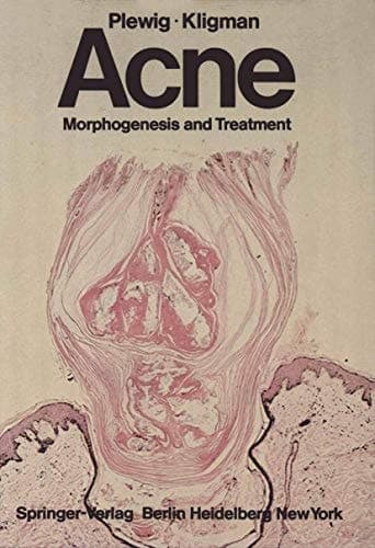 Acne: Morphogenesis and Treatment