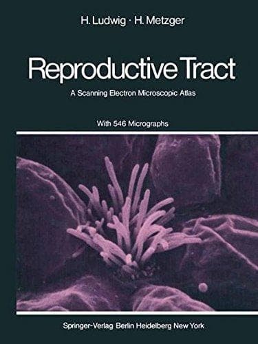 The Human Female Reproductive Tract A Scanning Electron Microscopic Atlas