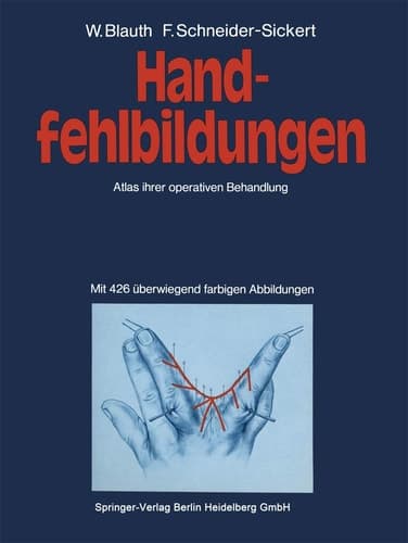 Handfehlbildungen Atlas ihrer operativen Behandlung