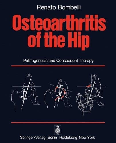 Osteoarthritis of the Hip Pathogenesis and Consequent Therapy