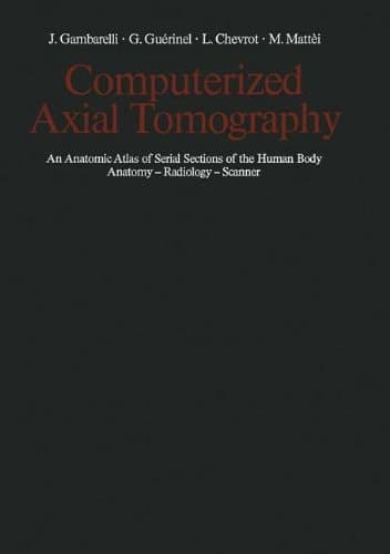 Computerized Axial Tomography An Anatomic Atlas of Serial Sections of the Human Body Anatomy — Radiology — Scanner