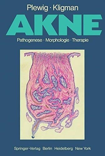 Akne