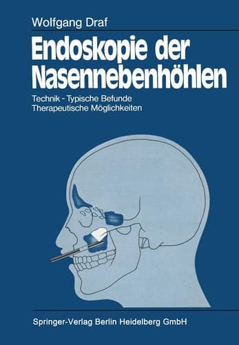 Endoskopie der Nasennebenhöhlen Technik · Typische Befunde, Therapeutische Möglichkeiten