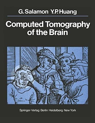 Computed Tomography of the Brain Atlas of Normal Anatomy