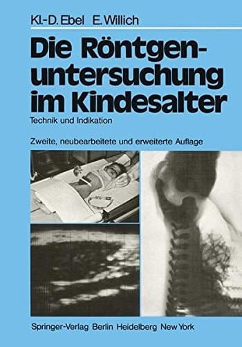 Die Röntgenuntersuchung im Kindesalter Technik und Indikation