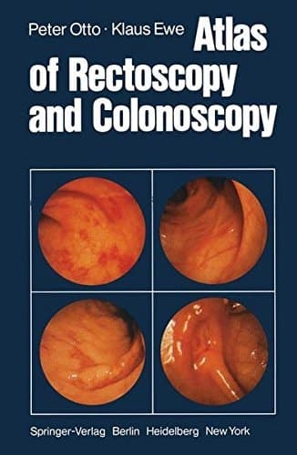 Atlas of Rectoscopy and Coloscopy