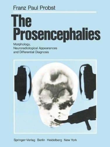 The Prosencephalies Morphology, Neuroradiological Appearances and Differential Diagnosis