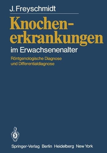 Knochenerkrankungen im Erwachsenenalter Röntgenologische Diagnose und Differentialdiagnose