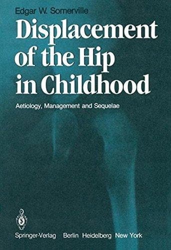Displacement of the Hip in Childhood Aetiology, Management and Sequelae