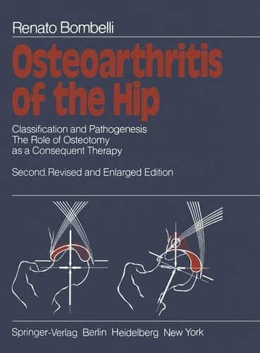 Osteoarthritis of the Hip Classification and Pathogenesis : the Role of Osteotomy as a Consequent Therapy