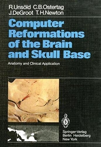 Computer Reformations of the Brain and Skull Base Anatomy and Clinical Application