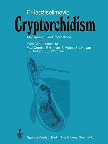 Cryptorchidism Management and Implications
