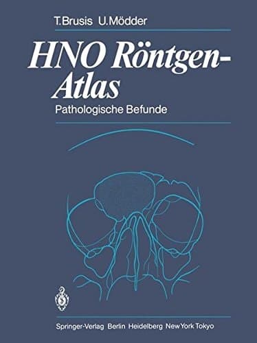 HNO Röntgen-Atlas Pathologische Befunde