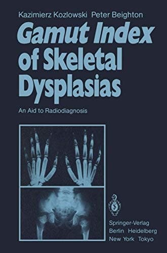 Gamut Index of Skeletal Dysplasias An Aid to Radiodiagnosis