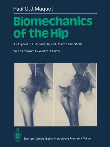 Biomechanics of the Hip As Applied to Osteoarthritis and Related Conditions