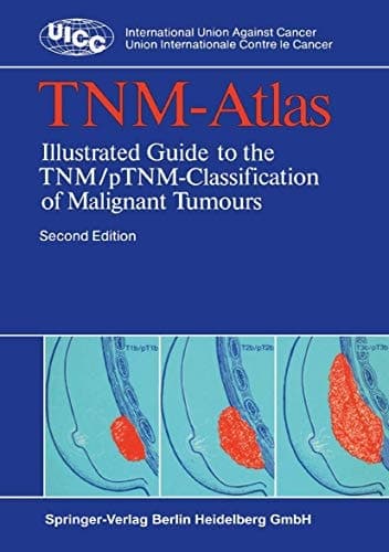TNM-Atlas: Illustrated Guide to the TNM/pTNM-Classification of Malignant Tumours (UICC International Union Against Cancer)