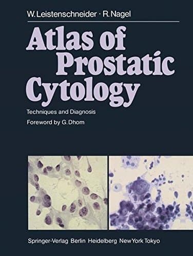 Atlas of Prostatic Cytology Techniques and Diagnosis