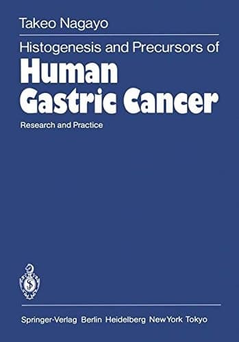 Histogenesis and Precursors of Human Gastric Cancer: Research and Practice