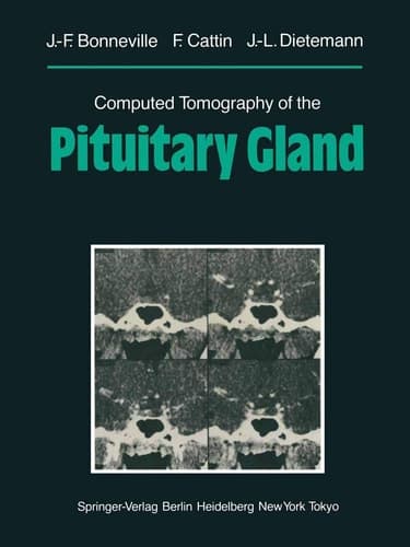 Computed Tomography of the Pituitary Gland With a Chapter on Magnetic Resonance Imaging of the Sellar and Juxtasellar Region, By M. Mu Huo Teng and K. Sartor