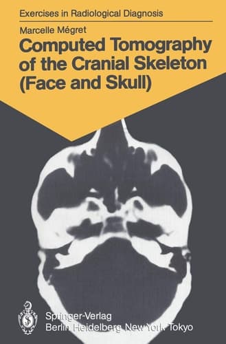 Computed Tomography of the Cranial Skeleton (Face and Skull) 58 Radiological Exercises for Students and Practitioners