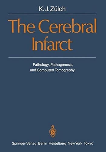 The Cerebral Infarct Pathology, Pathogenesis, and Computed Tomography