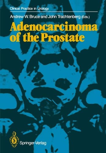 Adenocarcinoma of the Prostate (Clinical Practice in Urology)