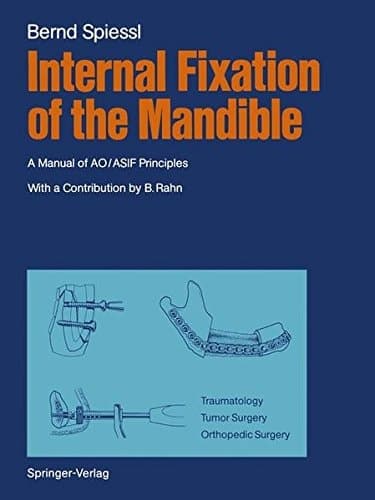 Internal Fixation of the Mandible A Manual of AO/ASIF Principles