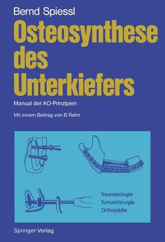 Osteosynthese des Unterkiefers Manual der AO-Prinzipien